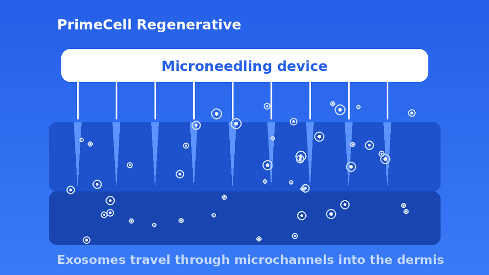 Does Microneedling With Exosomes Actually Work?