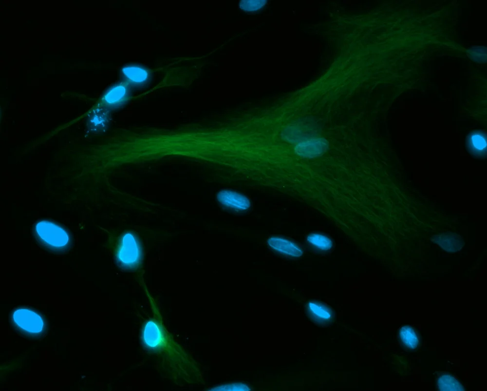 How Long Is Recovery After Stem Cell Therapy?