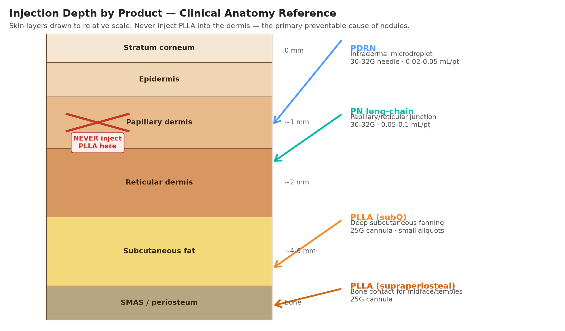 Illustration: injection depth by product