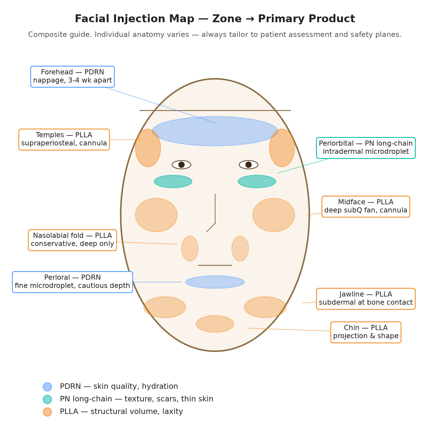Illustration: facial injection map
